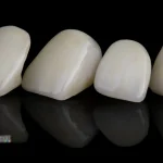 what-to-expect-when-getting-your-first-dental-crown